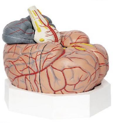 腦及腦動脈分解模型