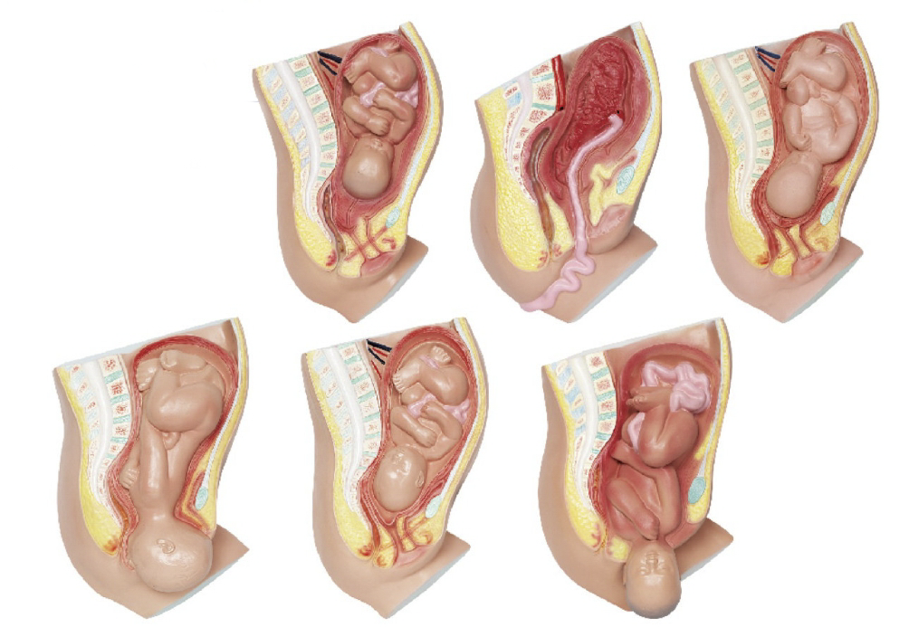 足月胎兒分娩過(guò)程（6部件