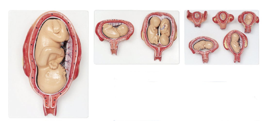 胎兒妊娠發(fā)育過程模型（8部件）